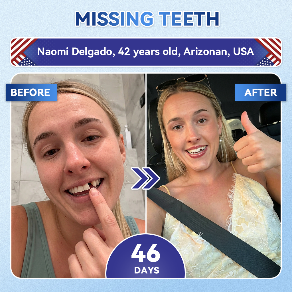 Your Smile~ NESLEMYÂź đŠ· Tideglusib FastâDissolving Tooth & Gum Repair Oral Strips âš (đ-đąđ§-đ đ đđđđźđąđ„đ đđ§đđŠđđ„ & đđđ§đđąđ§ âą đđđ«đđ§đ đđĄđđ§ đđźđŠđŹ âą đđ«đđđąđđđđ đđđ«đđđ« & đđđšđ« âą đđĄđąđđđ§đąđ§đ âą đđđšđ© đđšđšđđĄ đđđ§đŹđąđđąđŻđąđđČ)
