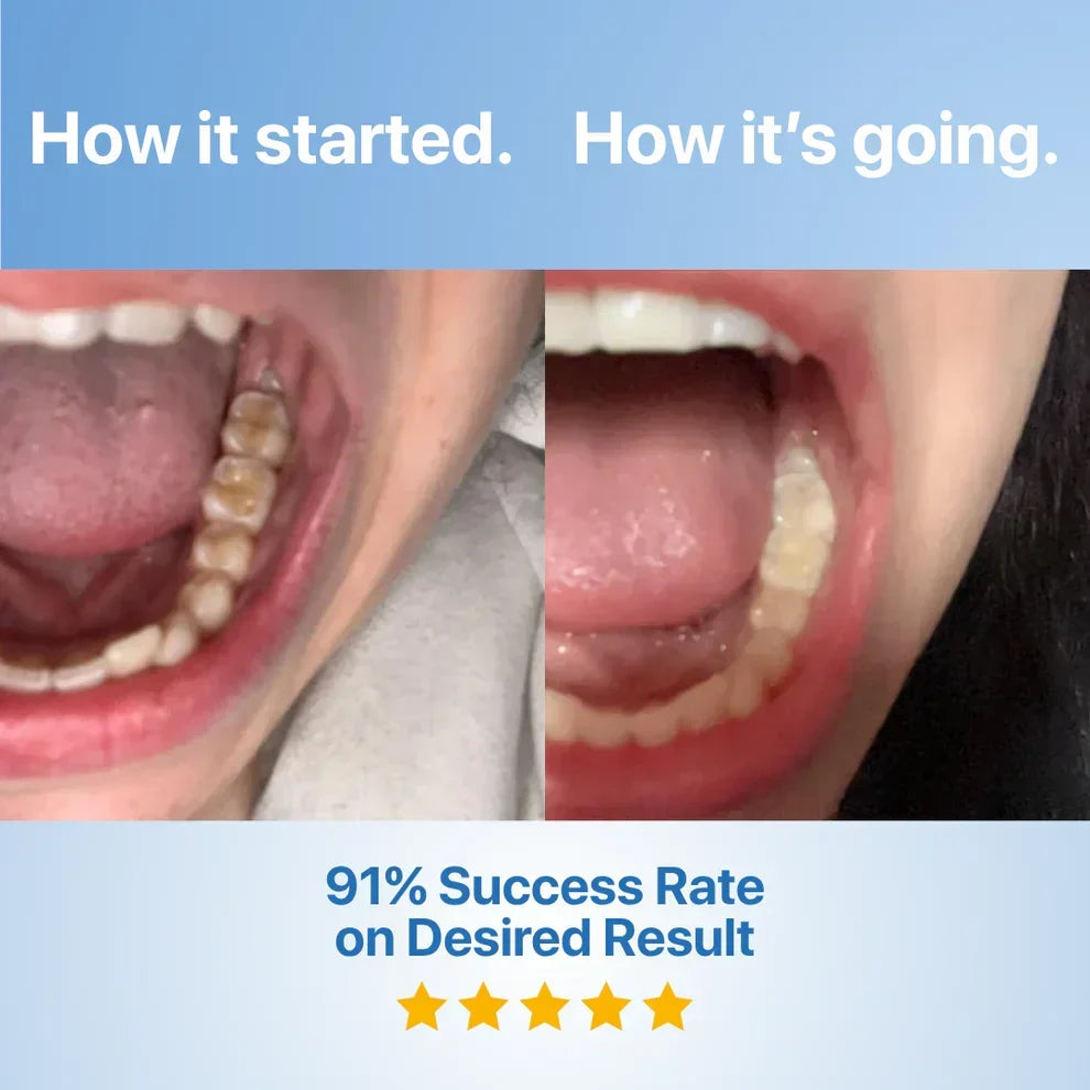 DentiGlow – Fluoride Free Tooth Repair Formula