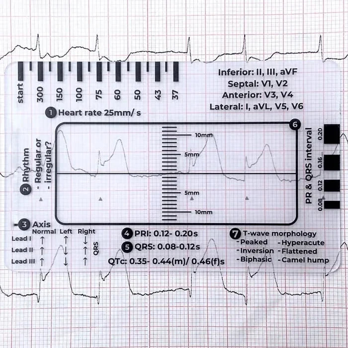 MediTrack – Professional ECG Assessment Pocket Guide