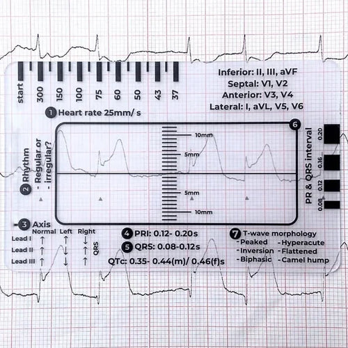 MediTrack – Professional ECG Assessment Pocket Guide