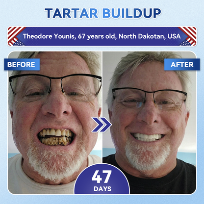 Your Smile~ NESLEMY® 🦷 Tideglusib Fast‑Dissolving Tooth & Gum Repair Oral Strips ✨ (𝟓-𝐢𝐧-𝟏 💎 𝐑𝐞𝐛𝐮𝐢𝐥𝐝 𝐄𝐧𝐚𝐦𝐞𝐥 & 𝐃𝐞𝐧𝐭𝐢𝐧 • 𝐒𝐭𝐫𝐞𝐧𝐠𝐭𝐡𝐞𝐧 𝐆𝐮𝐦𝐬 • 𝐄𝐫𝐚𝐝𝐢𝐜𝐚𝐭𝐞 𝐓𝐚𝐫𝐭𝐚𝐫 & 𝐎𝐝𝐨𝐫 • 𝐖𝐡𝐢𝐭𝐞𝐧𝐢𝐧𝐠 • 𝐒𝐭𝐨𝐩 𝐓𝐨𝐨𝐭𝐡 𝐒𝐞𝐧𝐬𝐢𝐭𝐢𝐯𝐢𝐭𝐲)