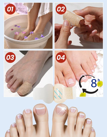 FungiCare – Advanced Nail Repair Patches