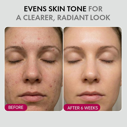 DermaGlow – Advanced Skin Renewing Treatment Cream