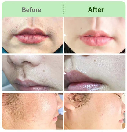 SkinEase – Smooth Finish Hair Removal Cream