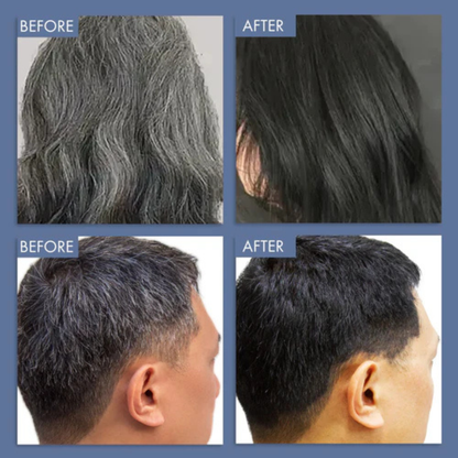 GrowHair – Proskire Anti-Grey Hair Serum