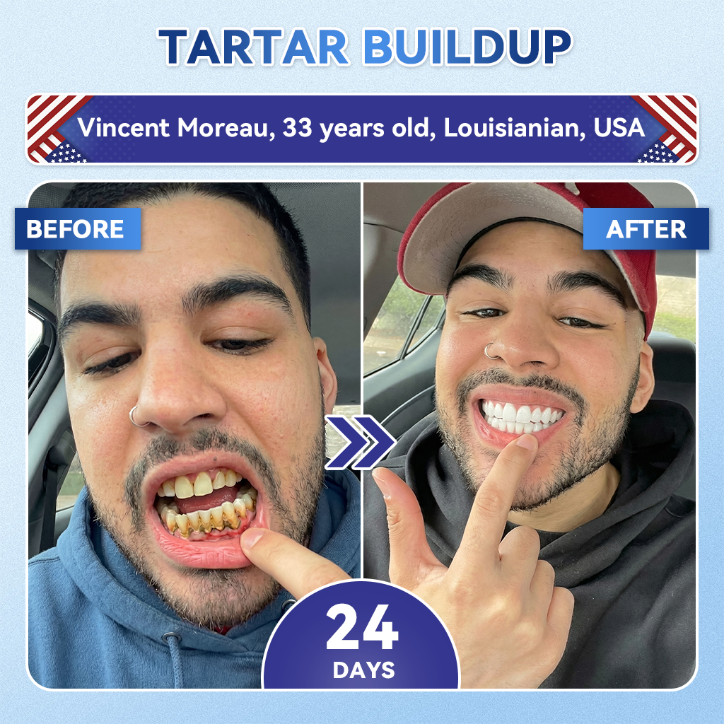 Your Smile~ NESLEMY® 🦷 Tideglusib Fast‑Dissolving Tooth & Gum Repair Oral Strips ✨ (𝟓-𝐢𝐧-𝟏 💎 𝐑𝐞𝐛𝐮𝐢𝐥𝐝 𝐄𝐧𝐚𝐦𝐞𝐥 & 𝐃𝐞𝐧𝐭𝐢𝐧 • 𝐒𝐭𝐫𝐞𝐧𝐠𝐭𝐡𝐞𝐧 𝐆𝐮𝐦𝐬 • 𝐄𝐫𝐚𝐝𝐢𝐜𝐚𝐭𝐞 𝐓𝐚𝐫𝐭𝐚𝐫 & 𝐎𝐝𝐨𝐫 • 𝐖𝐡𝐢𝐭𝐞𝐧𝐢𝐧𝐠 • 𝐒𝐭𝐨𝐩 𝐓𝐨𝐨𝐭𝐡 𝐒𝐞𝐧𝐬𝐢𝐭𝐢𝐯𝐢𝐭𝐲)