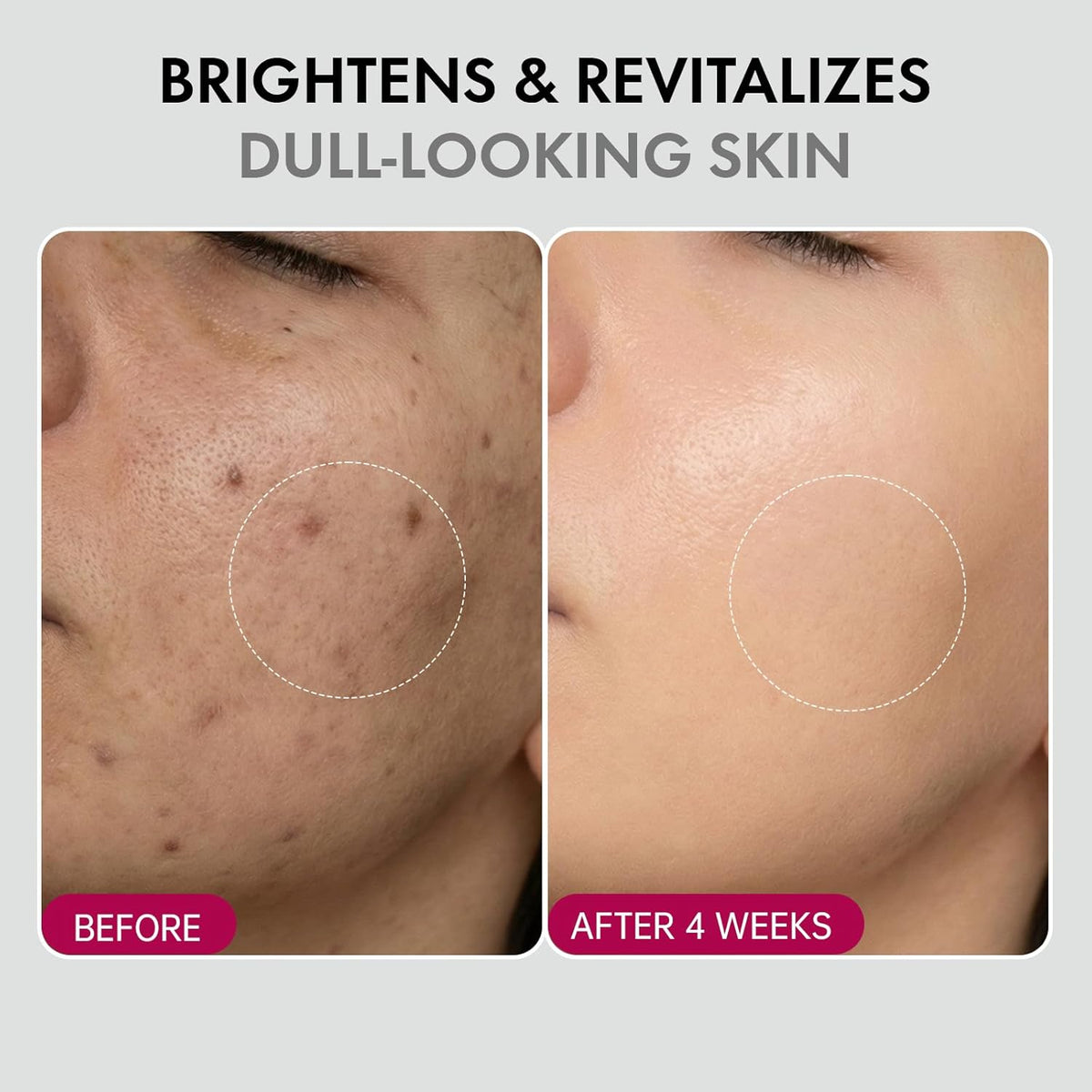 DermaGlow – Advanced Skin Renewing Treatment Cream