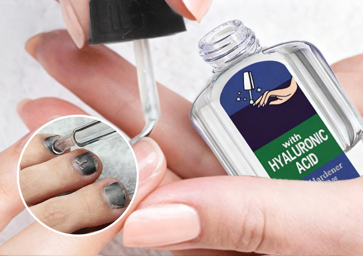 VitaNail – Rapid Antifungal Strength Pen