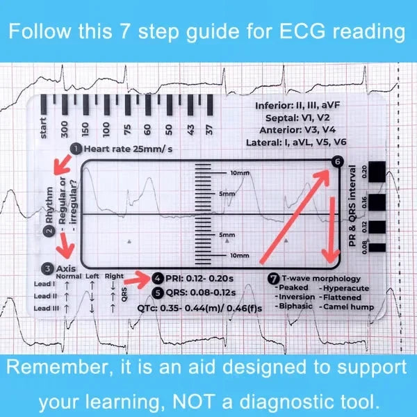 MediTrack – Professional ECG Assessment Pocket Guide
