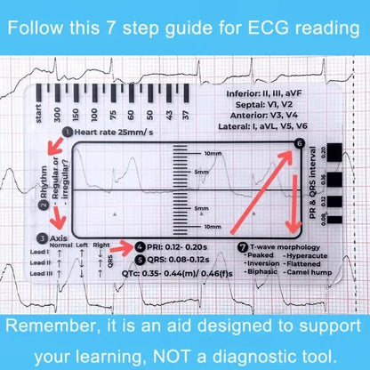 MediTrack – Professional ECG Assessment Pocket Guide
