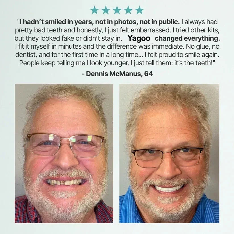 🌎Ends Today: 70% OFF! ⏰Yagoo™ Medical Full Denture with Strong Suctiond🦷Obtain American Dental Association (ADA) Certification