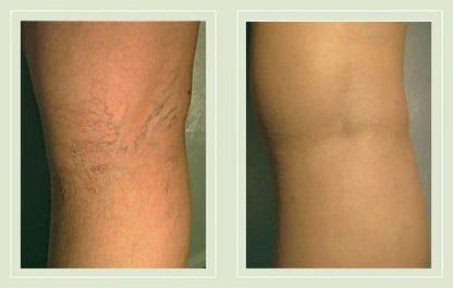 GlowLegs – Airbrushed Finish Leg Concealer