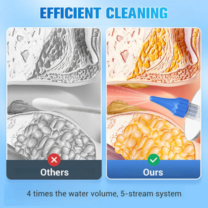 CleanEars – Precision Earwax Removal Tool Kit